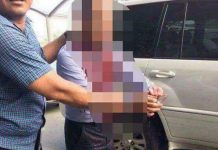 បុរសម្នាក់កាប់ជំនួយការ ឧកញ៉ា អឹង ប៊ុនហូវ រយះក្បាល!