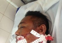 សន្តិសុខឯកជនម្នាក់ត្រូវជនមិនស្គាល់អត្តសញ្ញាណបាញ់រះរបួសធ្ងន់បន្ទាប់ពីដើរអើតឡឺមរថយន្ត