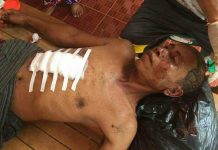 ស្លាប់ម្នាក់-រងរបួសធ្ងន់ម្នាក់ រវាងម្ចាស់នឹងចោចូលលួចមាន់